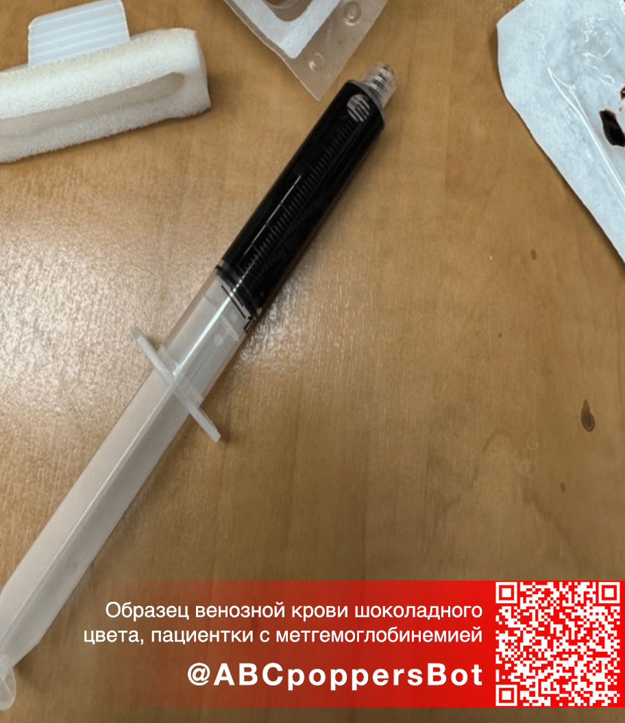 Если принять попперс внутрь в Саратове это вызывает метгемоглобинемию. Смертельное состояние Если принять попперс внутрь в Саратове это вызывает метгемоглобинемию. Смертельное состояние